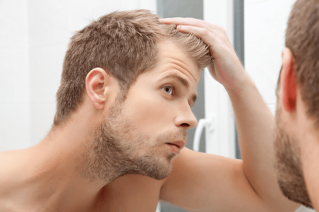 4 Must-Follow Rules for Balding Men