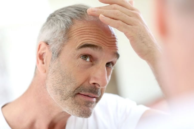 7 Simple Ways to Reduce Hair Loss