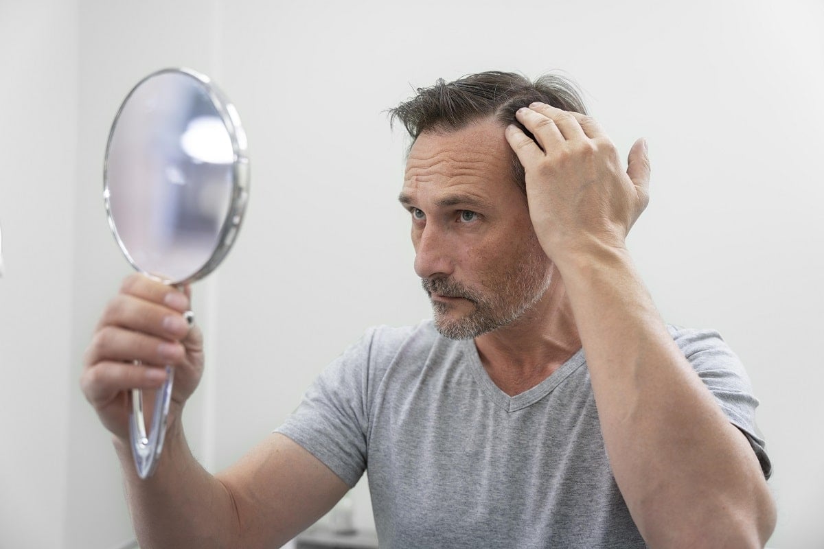 How to Effectively Prevent (and Reverse) Hair Loss 